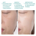 FOREO UFO 2: Fights Dark Spots & Aging