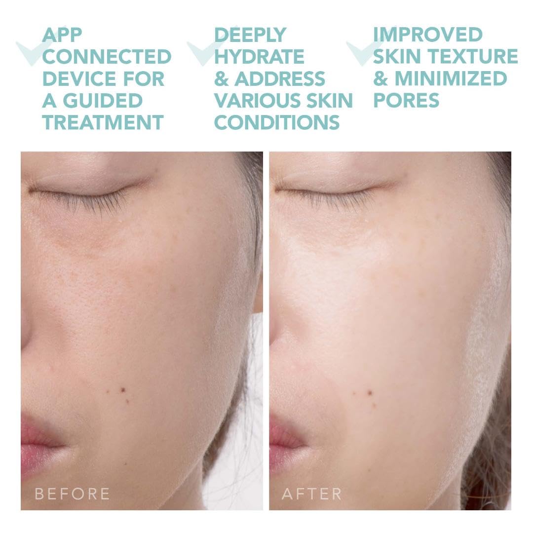 FOREO UFO 2: Fights Dark Spots & Aging