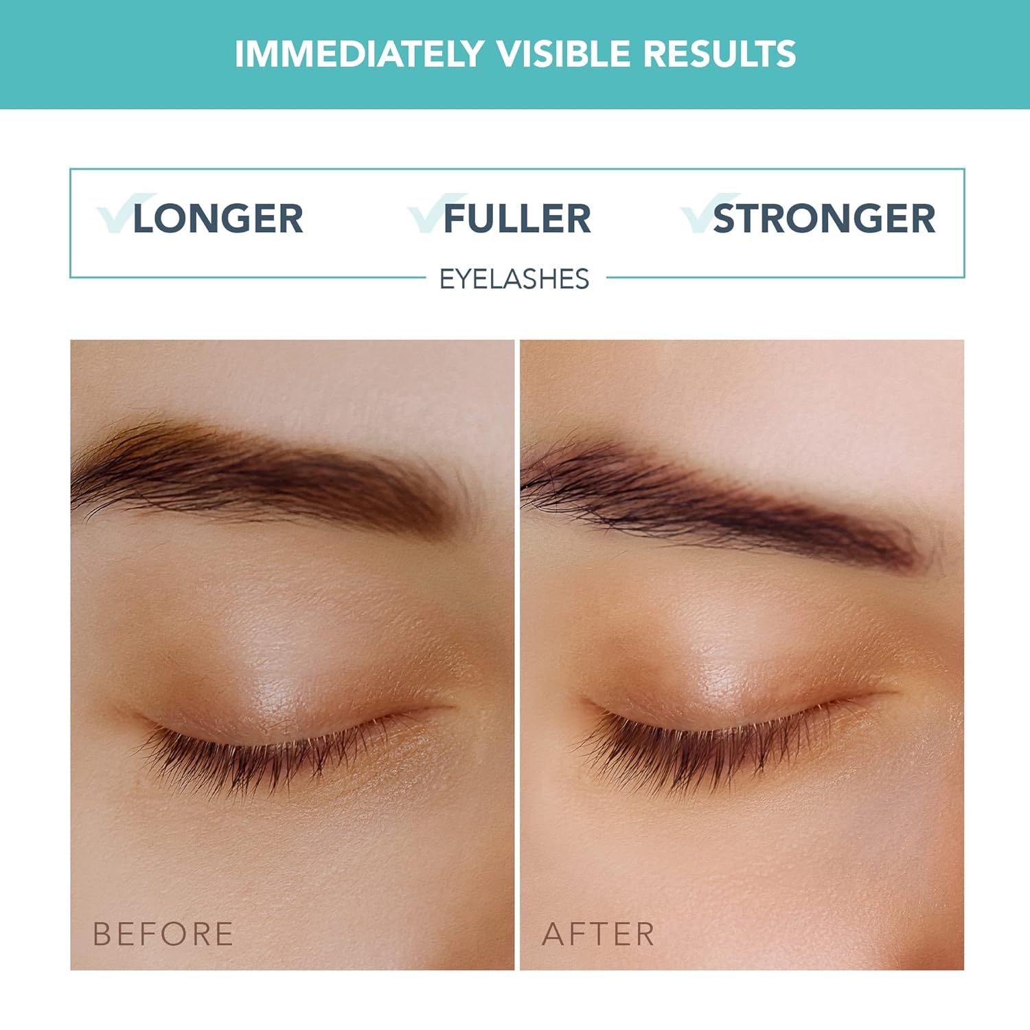 FOREO IRIS – Eyelash & Brow Serum with Phytokeratin, Arginine & Hyaluronic Acid