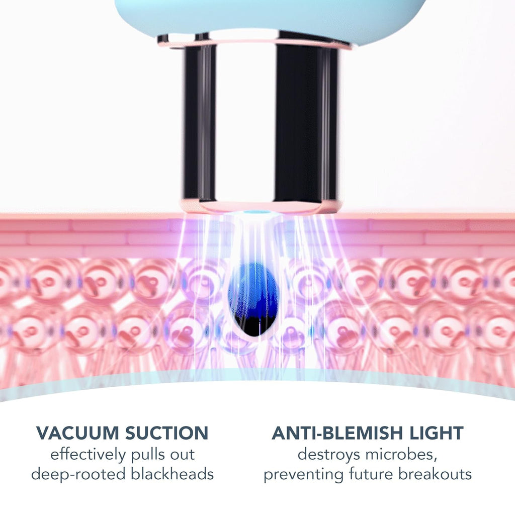 FOREO KIWI Blackhead Remover Bundle – Pore Vacuum & LUNA Micro-Foam Cleanser 2.0 (3.5 oz)