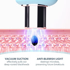 FOREO KIWI Blackhead Remover Bundle – Pore Vacuum & LUNA Micro-Foam Cleanser 2.0 (3.5 oz)