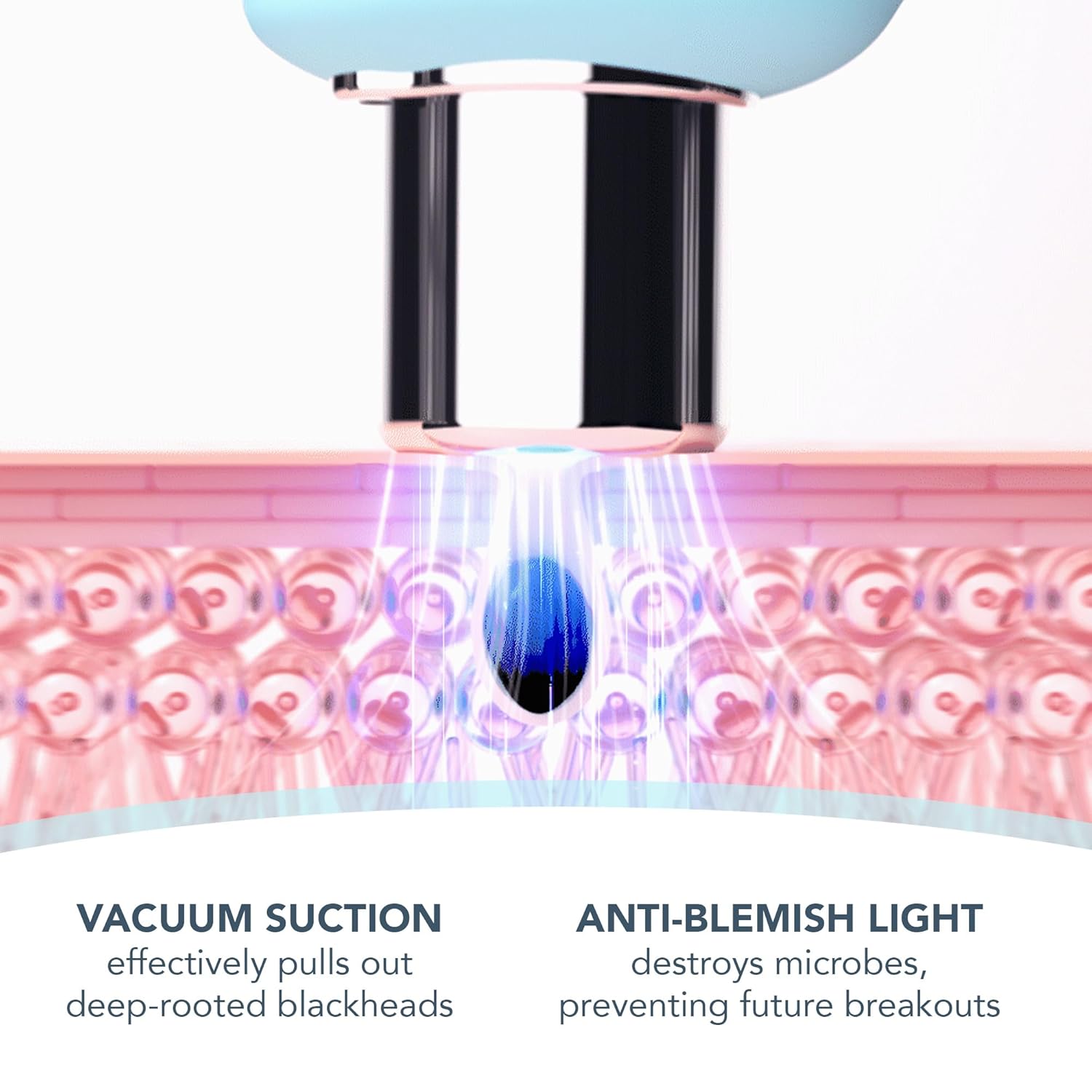 FOREO KIWI Blackhead Remover Bundle – Pore Vacuum & LUNA Micro-Foam Cleanser 2.0 (3.5 oz)