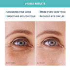 FOREO IRIS – Cooling Hydrogel Eye Patches for Brightening & Depuffing