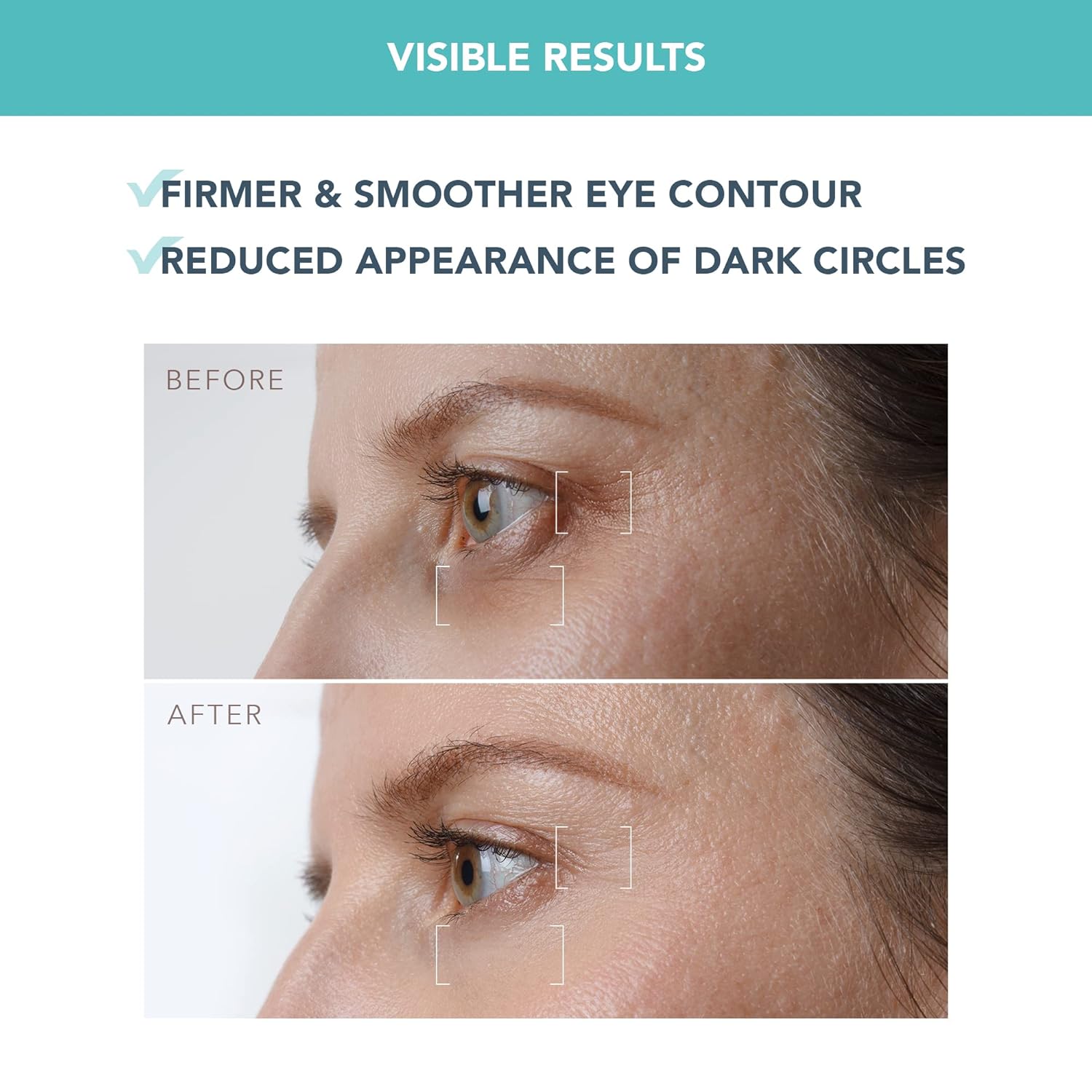 FOREO IRIS PM Eye Serum – Retinol & Vitamin E for Dark Circles, Puffiness & Fine Lines