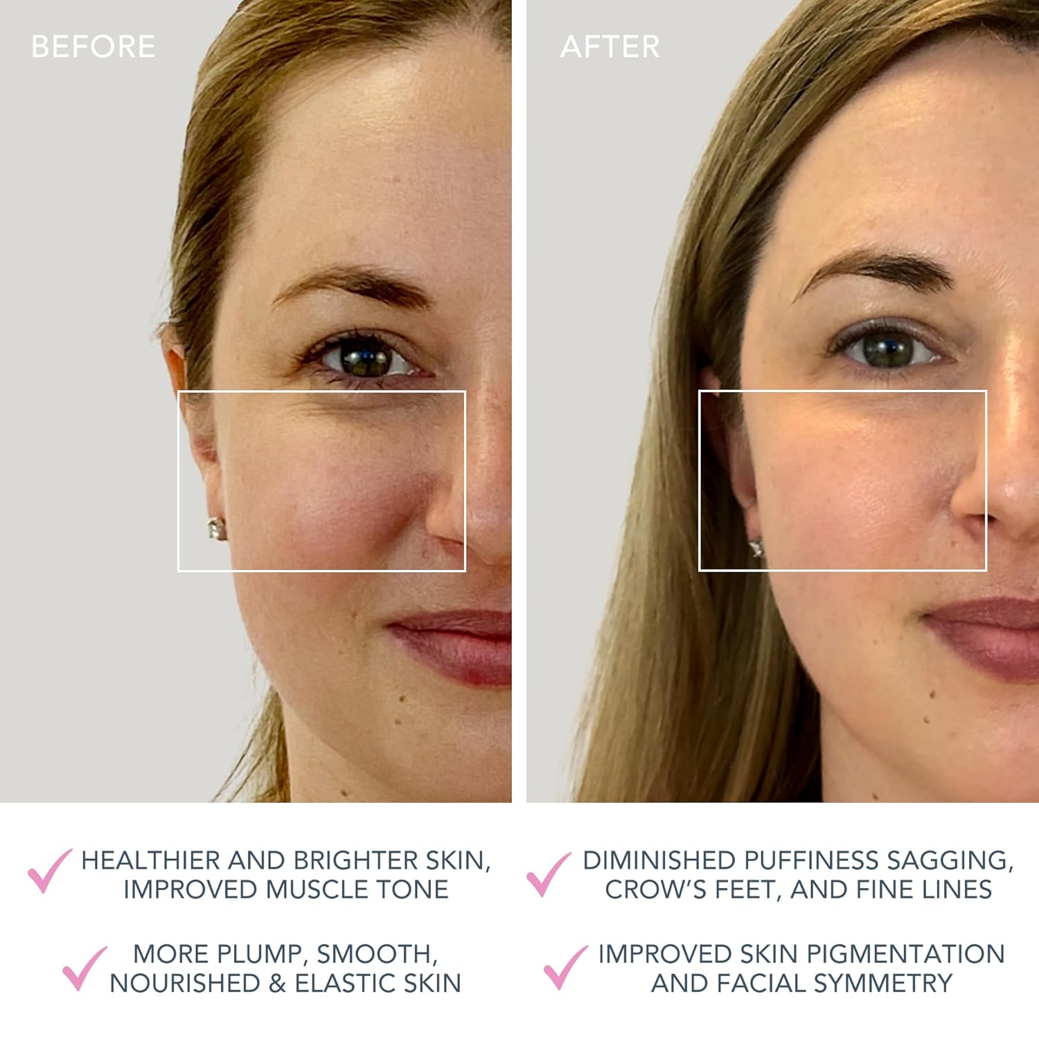 FOREO BEAR Mini – Microcurrent Face Sculpting & Firming Device