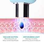 FOREO KIWI – Microdermabrasion & Blackhead Remover