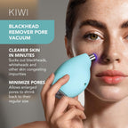 FOREO KIWI Blackhead Remover Bundle – Pore Vacuum & LUNA Micro-Foam Cleanser 2.0 (3.5 oz)
