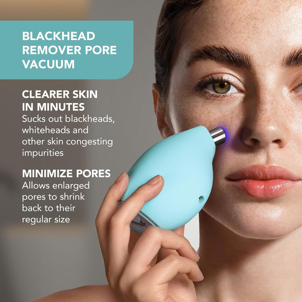FOREO KIWI – Microdermabrasion & Blackhead Remover