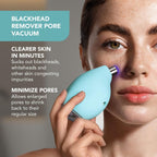 FOREO KIWI – Microdermabrasion & Blackhead Remover