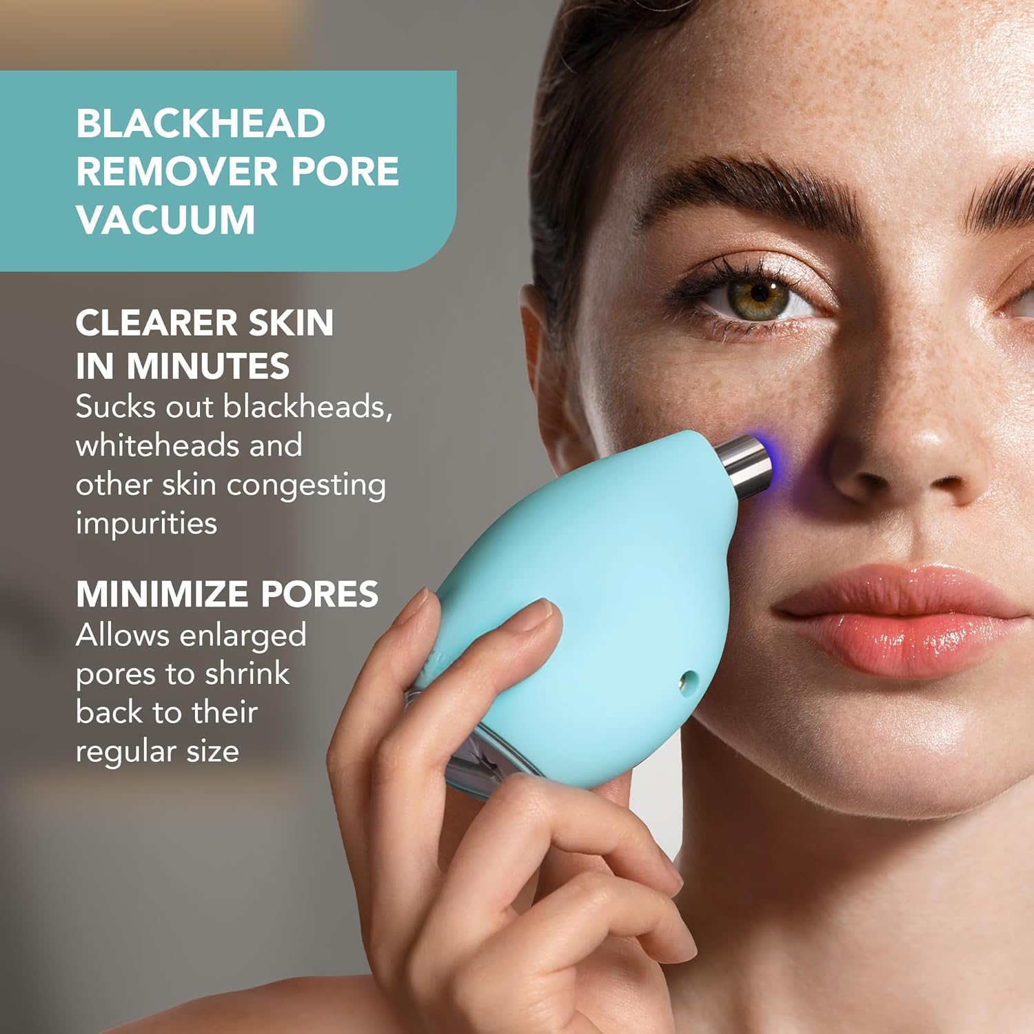 FOREO KIWI – Microdermabrasion & Blackhead Remover